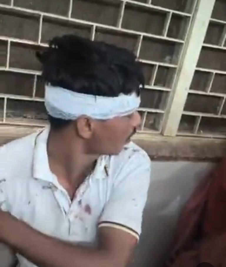 हमले।में घायल कुशवाह परिवार का सदस्य