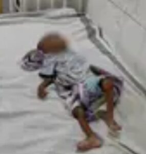 महिला बाल विकास में चल रही वसूली, दम तोड़ रहे कुपोषित, सिविल सर्जन रोक रहे मीडिया