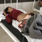 सावधान: घर के बाहर खड़ा मवेशी कहीं आपका पेट न फाड़ दे, आशा के पेट में आए 40 टांके