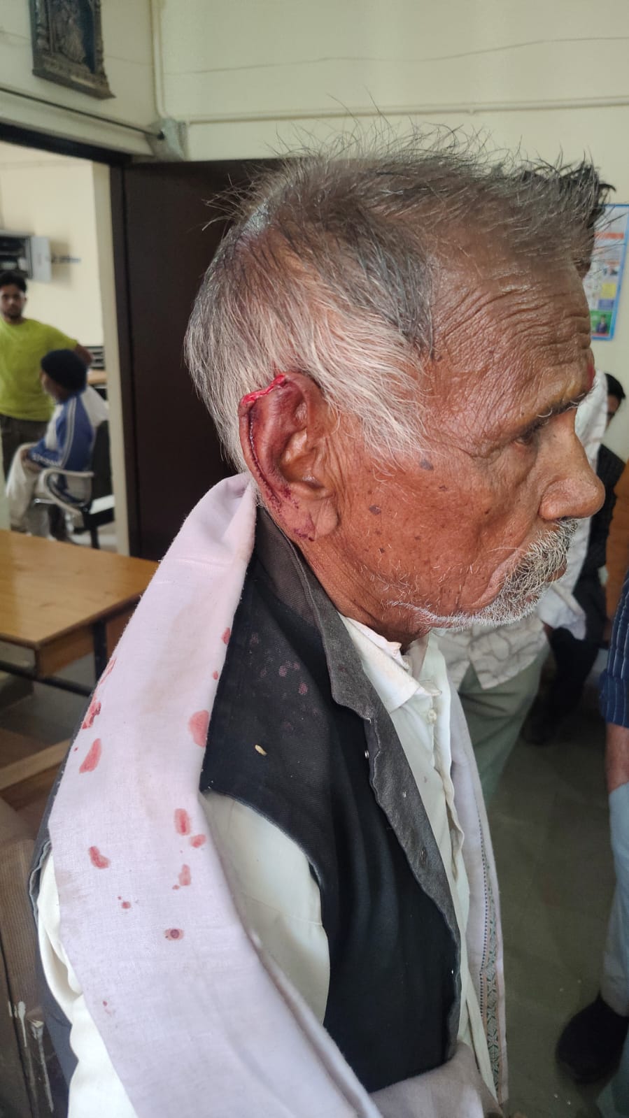 नशेड़ियों के निशाने पर सोने-चांदी का सामान, वृद्ध के कान से सोने की बाली खींचने से कटा कान