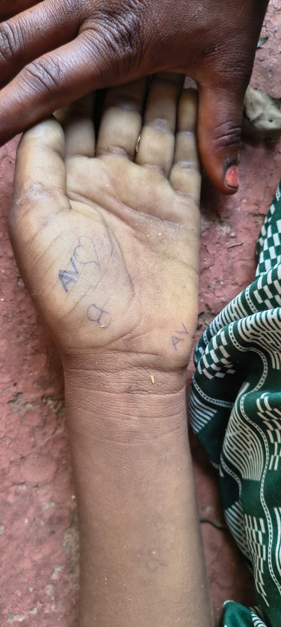 जीते जी नहीं मिले तो क्या, मर कर तो मिलेंगे: प्रेमी की हत्या के बाद प्रेमिका ने भी घर में फांसी लगाकर दी अपनी जान